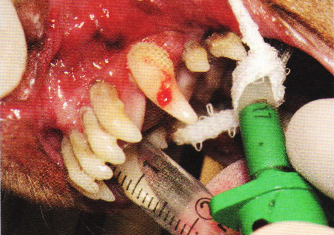 Pacient s obnaženými kořeny řezáků a akutním zánětem sliznice dutiny ústní a parodontálních tkání měsíc po odstranění zubního kamene