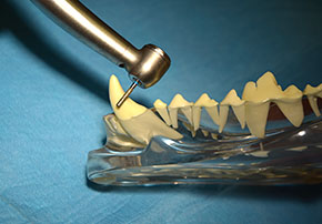 Broušení skloviny diamantovým brouskem na zdravý dentin