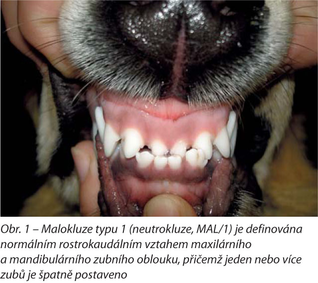 Malokluze typu 1 (neutrokluze, MAL/1) je definována normálním rostrokaudálním vztahem maxilárního a mandibulárního zubního oblouku, přičemž jeden nebo více zubů je špatně postaveno
